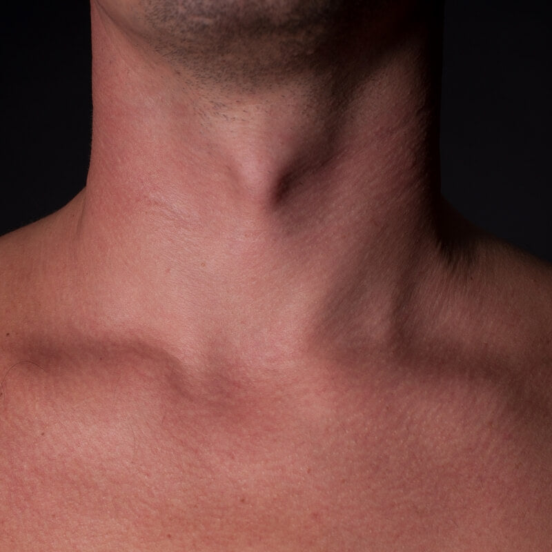 mens nexk wax in toronto