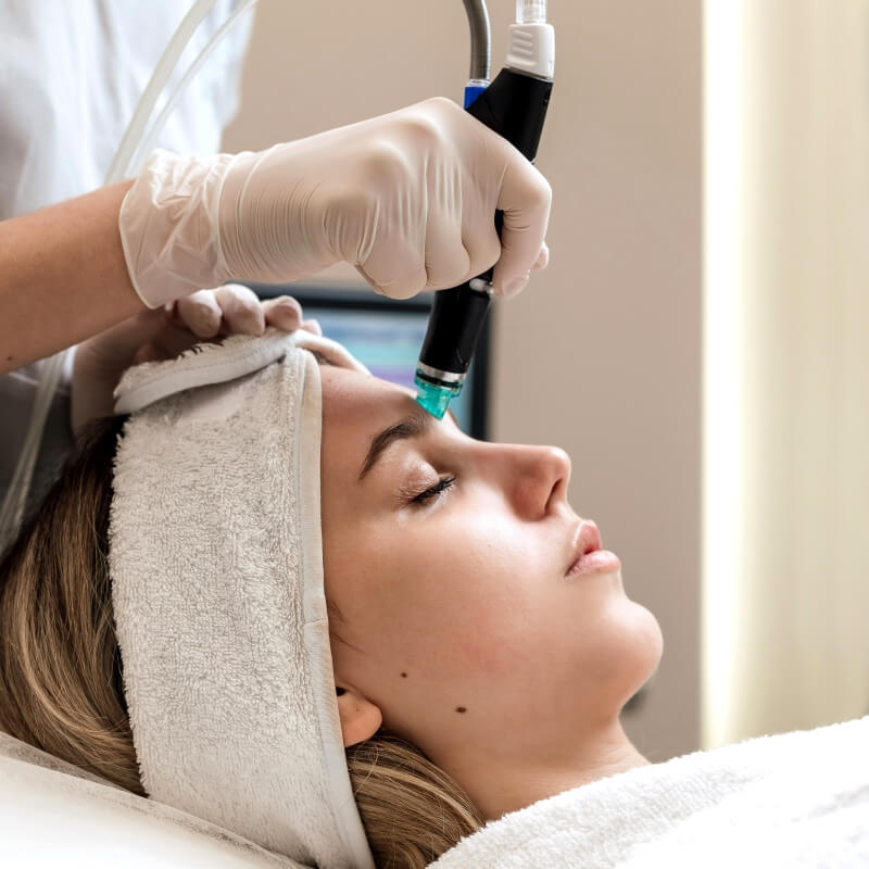 micro dermabrasion facials in toronto