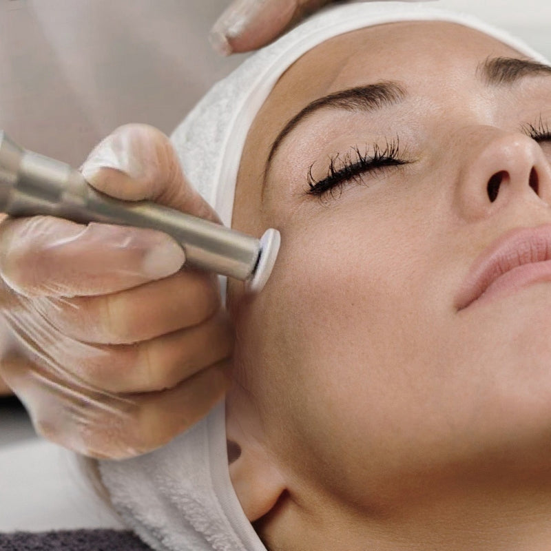 microneedling treatment toronto