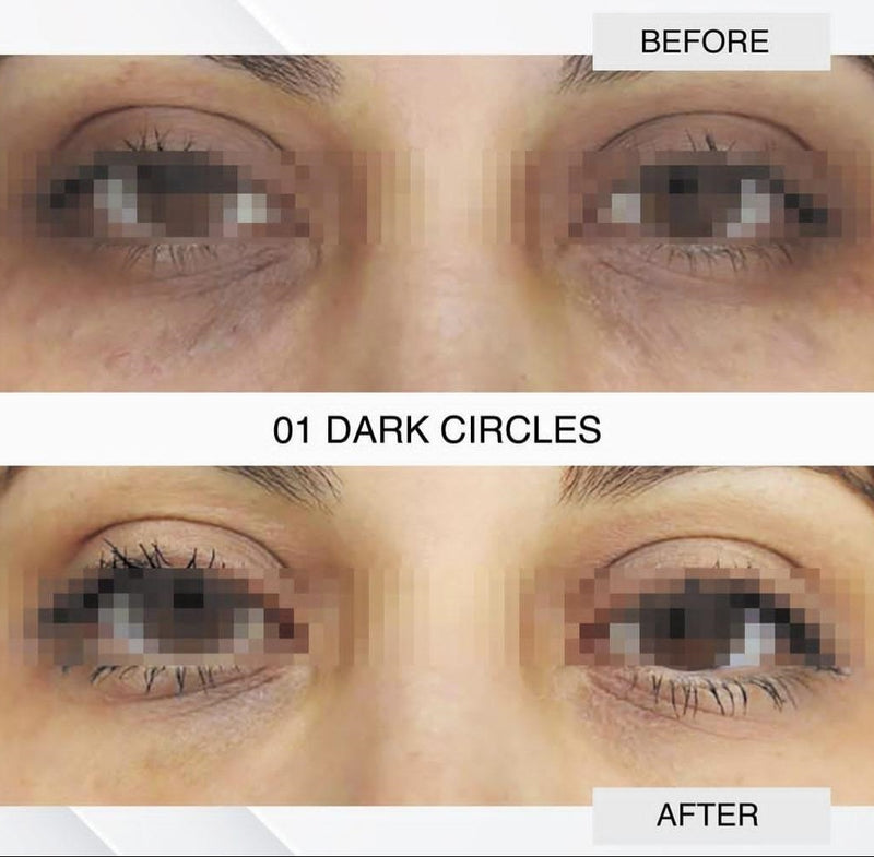 Dark Circles