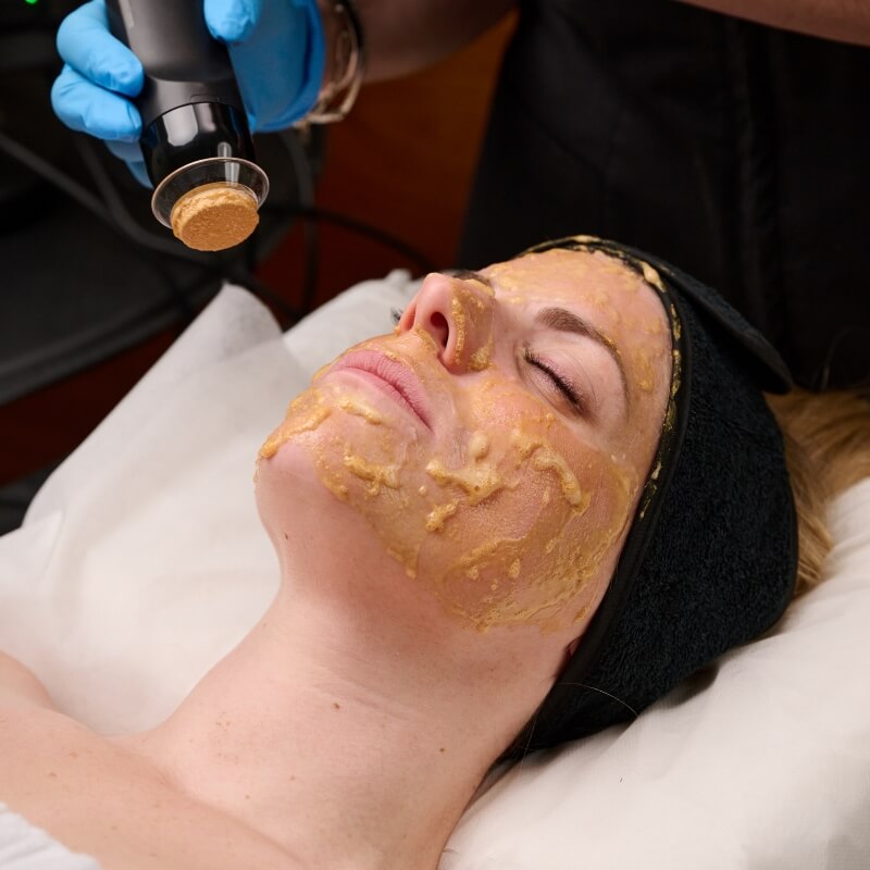 Hydra gold facial toronto