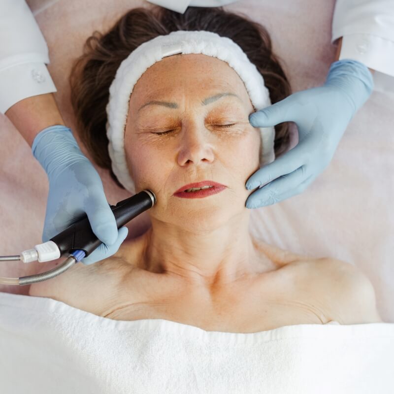 microdermabrasion facial treatment in Toronto